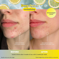 Deep Detox Pore Control Raw Juice Sheet Mask